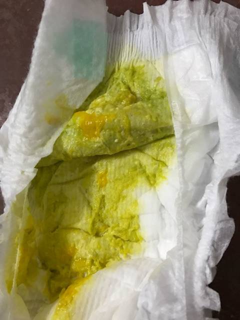 两个月宝宝粑粑变稀还是绿色,有鸡蛋臭味