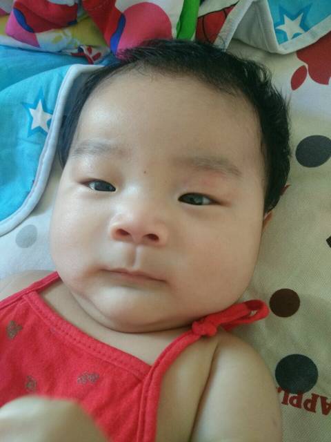 大家帮忙看看_我宝宝出生时眼皮就有两条红印