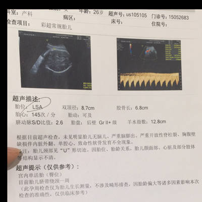 问答 怀孕期 推荐回答 36周了,还是准备破妇产