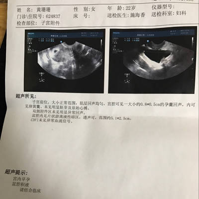 怀孕4周 做了b超检查出有盆腔炎、积液有5.1*