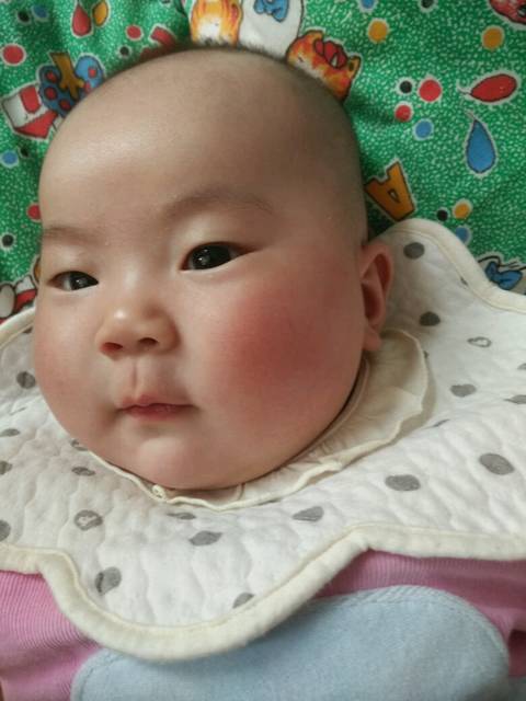 宝贝脸颊红怎么回事_出生五天后出过湿疹,不严