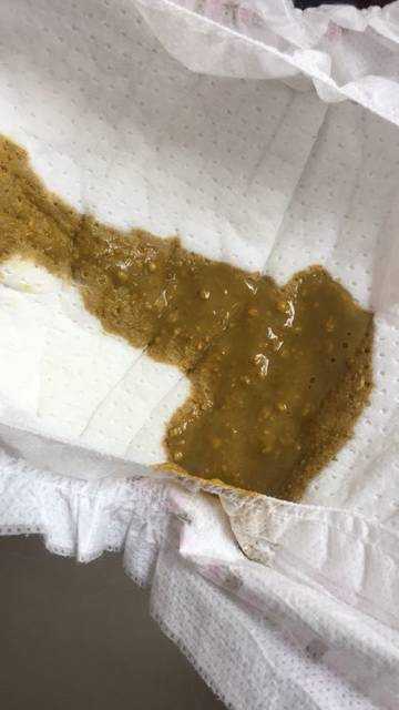 三个月双胞胎宝宝大便是这样的_宝宝都这样大