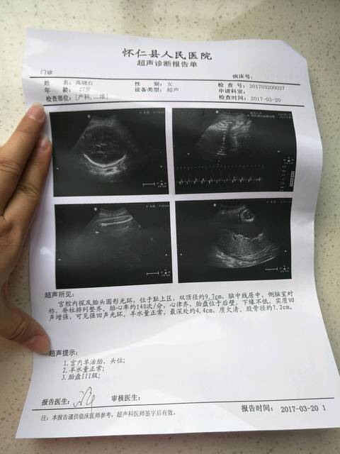 双顶径偏大了_今天做的b超,懂得的帮忙看一下