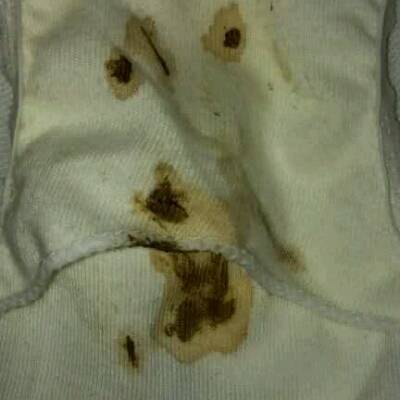 排卵期同房后8天内裤上有褐色分泌物,第7天浅