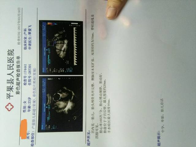 是否要去做羊水穿刺?_医生说唐氏筛查高危怎