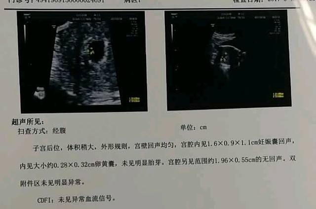 老二图片图片_男娃是眼睛,现在来了素描,虽然老大女孩女娃还是大全女生图片