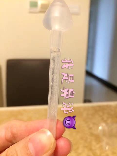 40天宝宝鼻屎堵塞,求妙招!