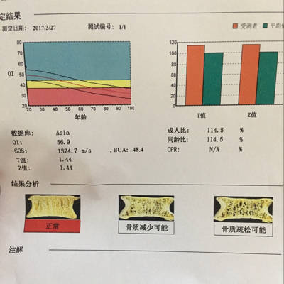 第一次做骨密度 下面这三个图很是让我烦恼 是好还是不好