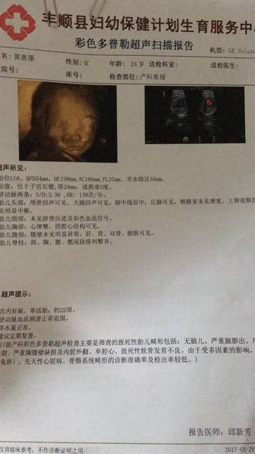 四维彩超叫复查好担心_做四维彩超下午,医生照