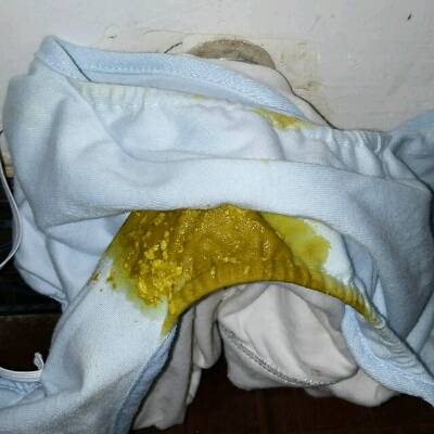 我家宝宝两个半月了,半个月前羊奶换成了牛奶