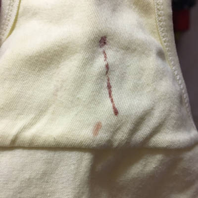 不知道是不是吃太多凉性的东西这俩天内裤上有