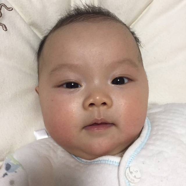 脸颊红_不知是不是春天的原因,宝宝脸蛋白天正