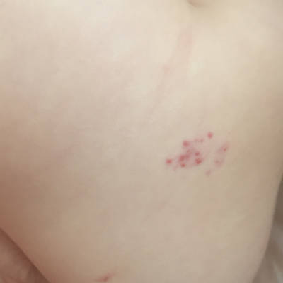 宝宝屁股上有红色的点点,从出生到现在六个月