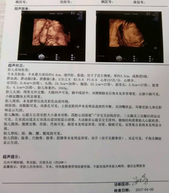 双肾集合系统未见分离确定是女孩吗_4维结果