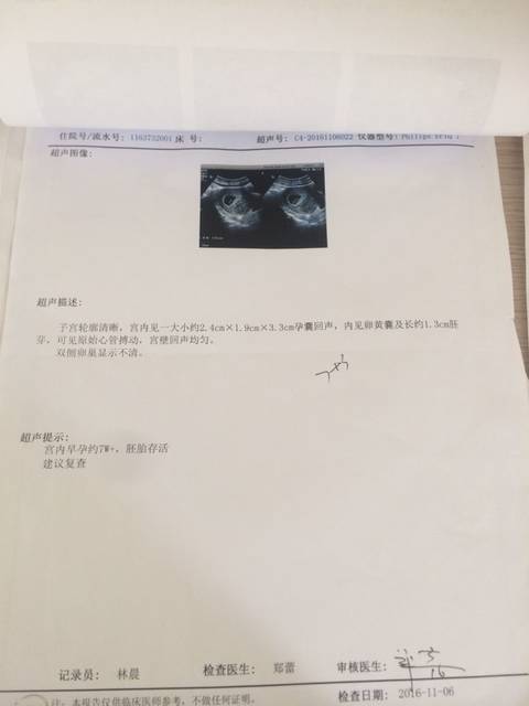 孕囊大小看性别_有会看孕囊大小看性别的吗?