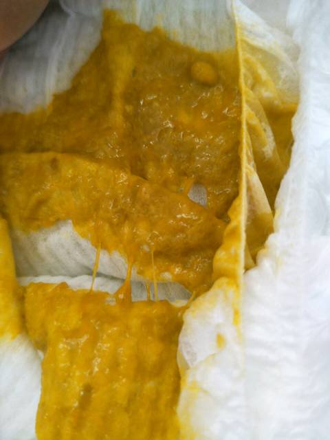 宝宝拉肚子,_四个月宝宝拉肚子,吃了马上就拉