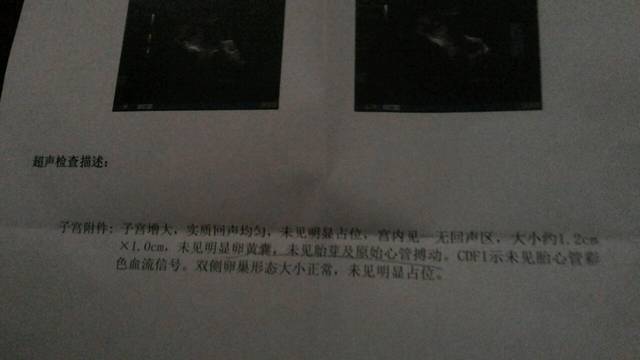 各位宝妈好_最后一次月经3.5,昨晚有一点点褐