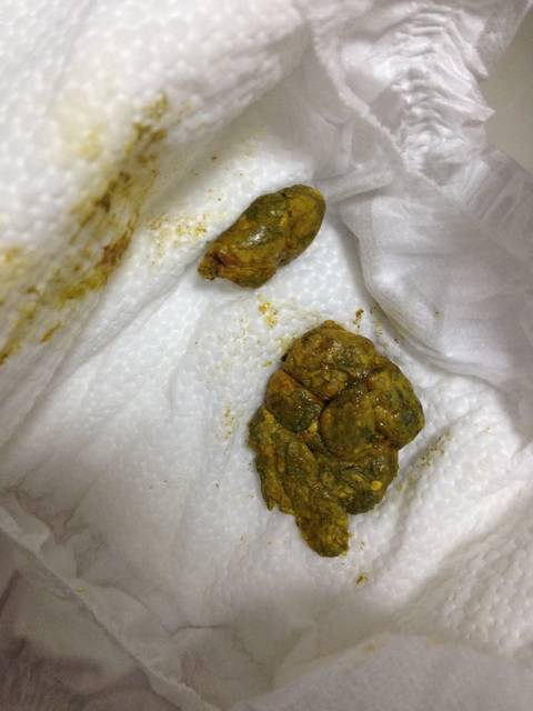 宝宝大便硬硬的_我宝宝出世15天 拉了胎便之后一直没
