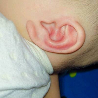 宝宝耳朵有一点点红红的 还有一点硬硬的是怎