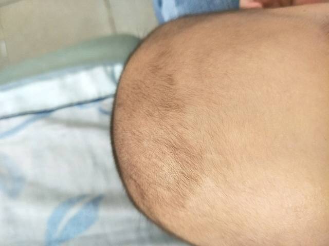 这样算卤门凸起吗?_大家帮我看看_宝宝树