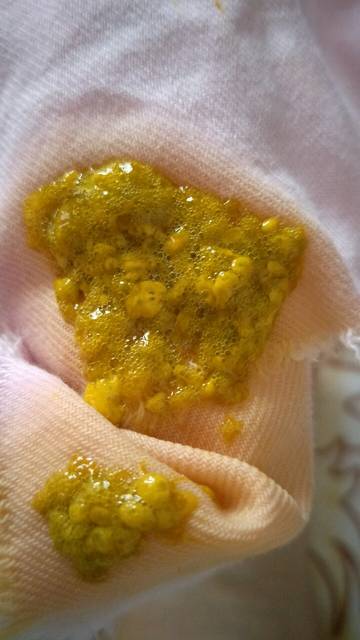 宝宝拉肚子_各位宝妈宝宝还在月子里吃好母乳