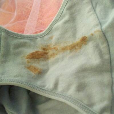 孕五周三天晚上发现内裤上有褐色分泌物怎么回