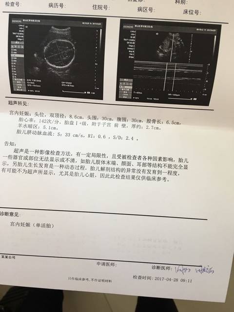 30周宝宝偏大3周,血糖血压体重都正常_30周宝