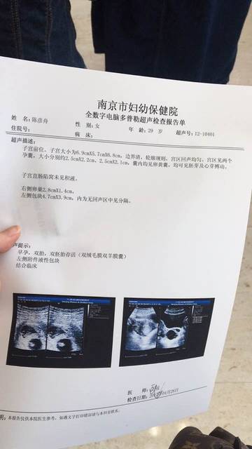 求宝妈看看异卵双胞胎性别?_求宝妈帮忙看看