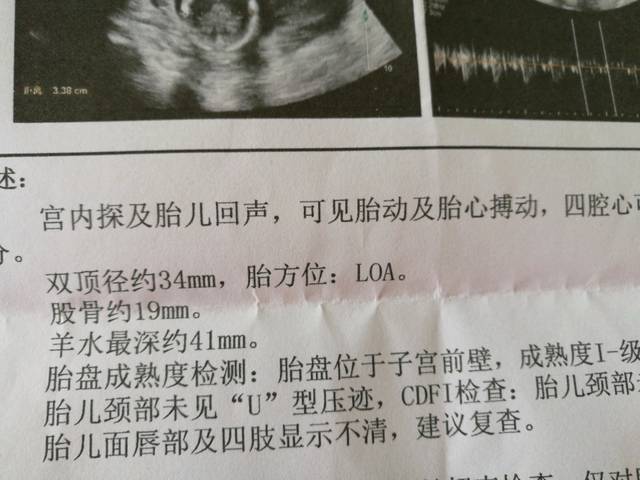 怀孕四个月胎儿偏小吗?