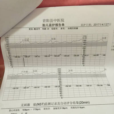 胎心率过快 做的时候老是在动 也吸氧了