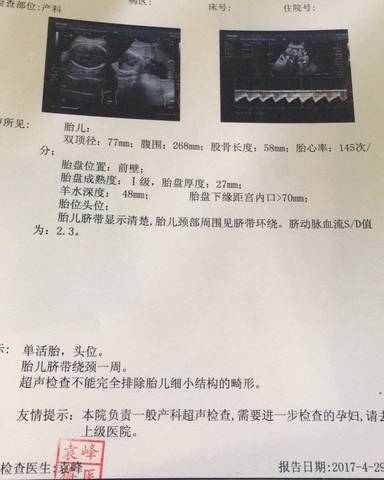 B超测男女,把单子发给我就好。_我大姨是妇产