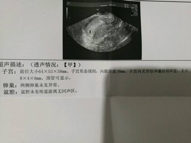 B超单显示的胎儿是否营养不良呀?_子宫:前位