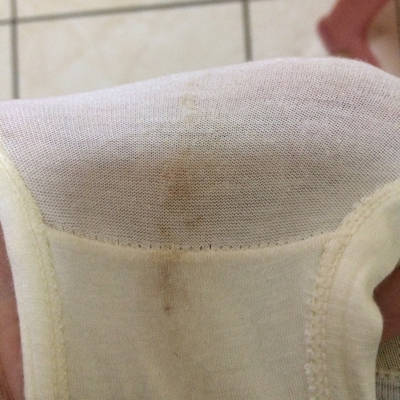 之前一直有妇科炎症没好,白带颜色是黄色的,这个月刚测出怀孕,分泌物