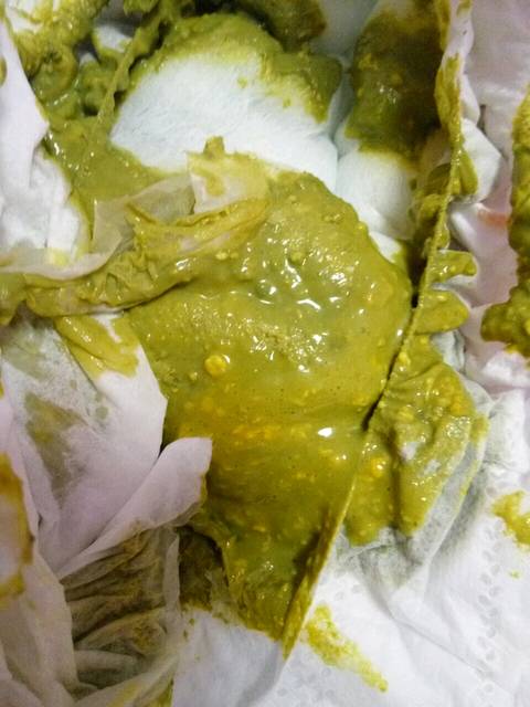 宝宝一个月了拉屎黄绿色而且还有奶瓣,正常吗