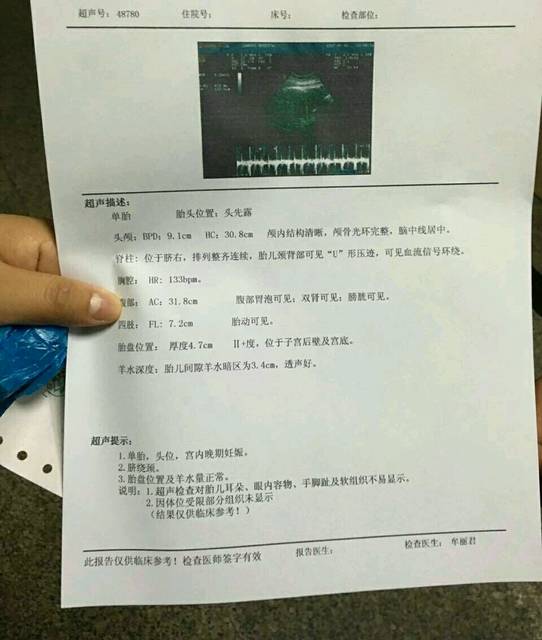 树下 小圈子 生男生女谈 亲们,b超单和孕肚照,看看是男宝还是女宝