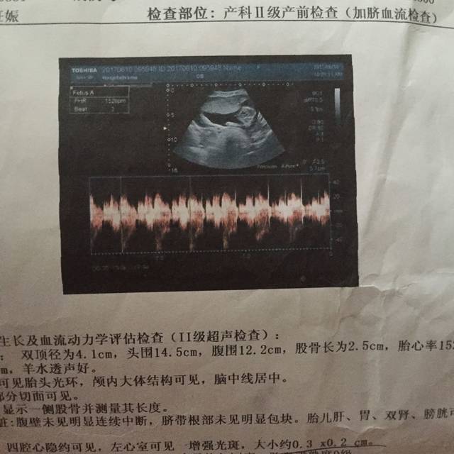 b超单上胎儿两腿之间一个小亮点是儿子 三条白线是女儿?