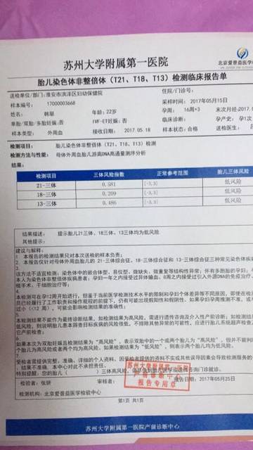 无创DNA报告怎么看男女?_听说无创DNA报告