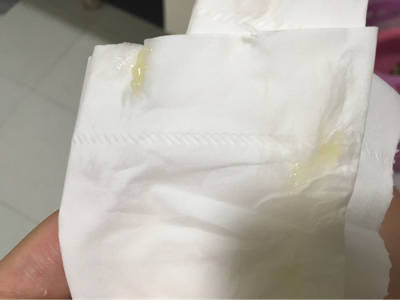39周加1刚刚上厕所纸上有一点点果冻状的白色分泌物是