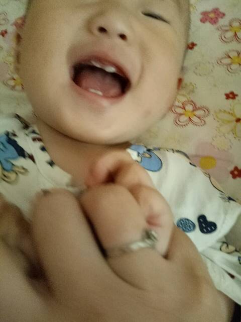 宝宝门牙长歪了怎么办_宝宝一周一才开始长牙