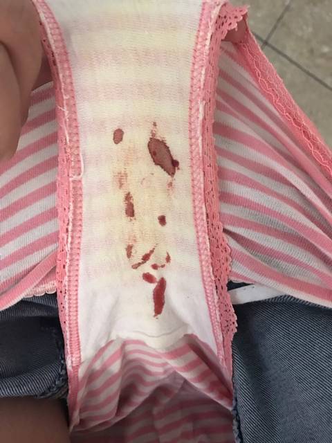 早晨见红了怎么办?