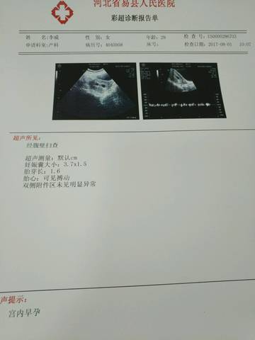 孕囊数据看男女求验证