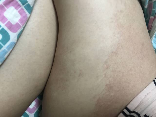 宝妈们 有没有花大腿的