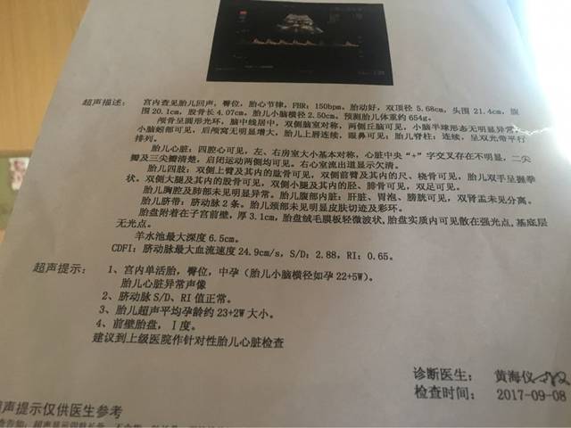 胎儿心脏异常声像怎么回事_ 急