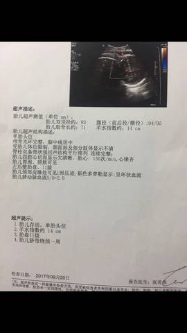 四院b超室有个男医生极其不负责任!