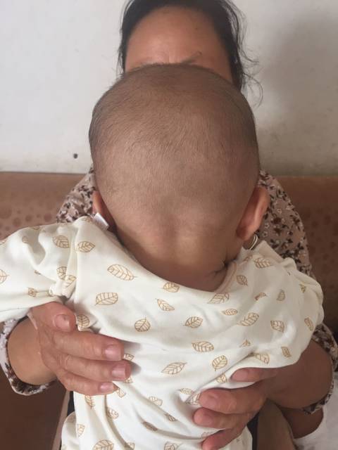 四个月的宝宝头老是往左边歪怎么办?_头可以