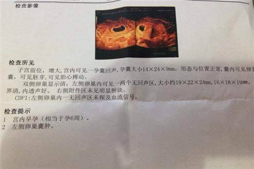 B超单看男孩女孩?3分钟教你看懂一张B超单_