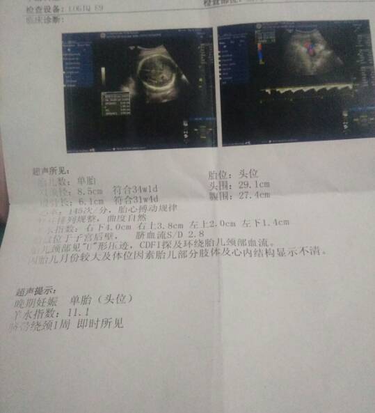 大家看昨天的B超单双顶径和羊水指数的问题_