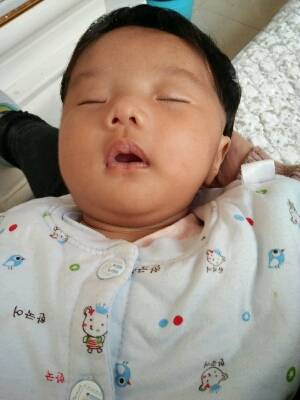 宝宝快2 个月了,出生时县城医院说怀疑斜颈,两