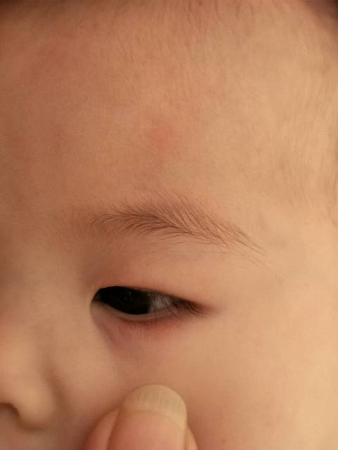 宝宝下眼皮红是怎么回事。