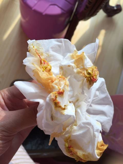 宝宝21天 便血怎么办(有图)_宝宝21天 便血怎么